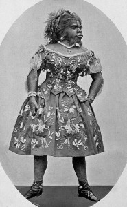 In the 19th century, Julia Pastrana, who suffered from excessive hair growth, was sold to a carnival sideshow and exhibited as a freak. Image via Wikimedia Commons.